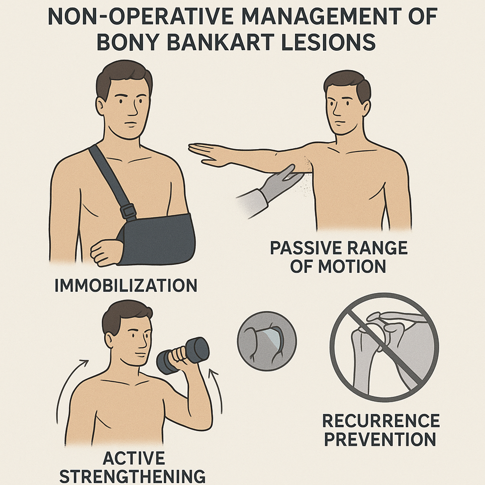 Non Operative bony bankart management