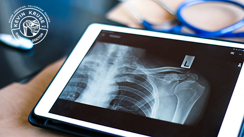 total shoulder replacement